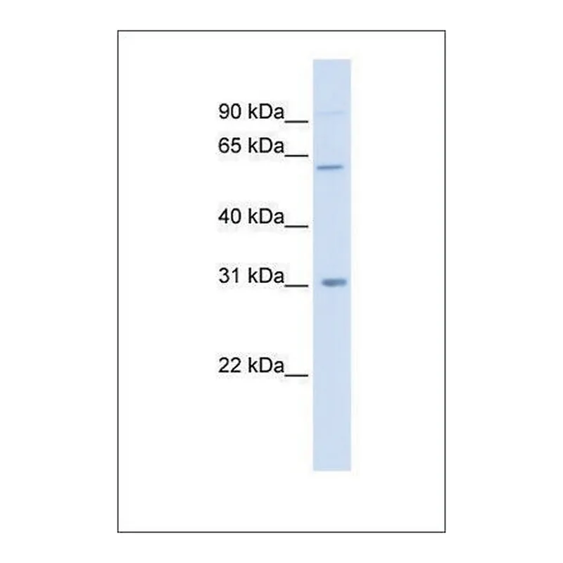 Merck Anti-CHST2 antibody produced in rabbit