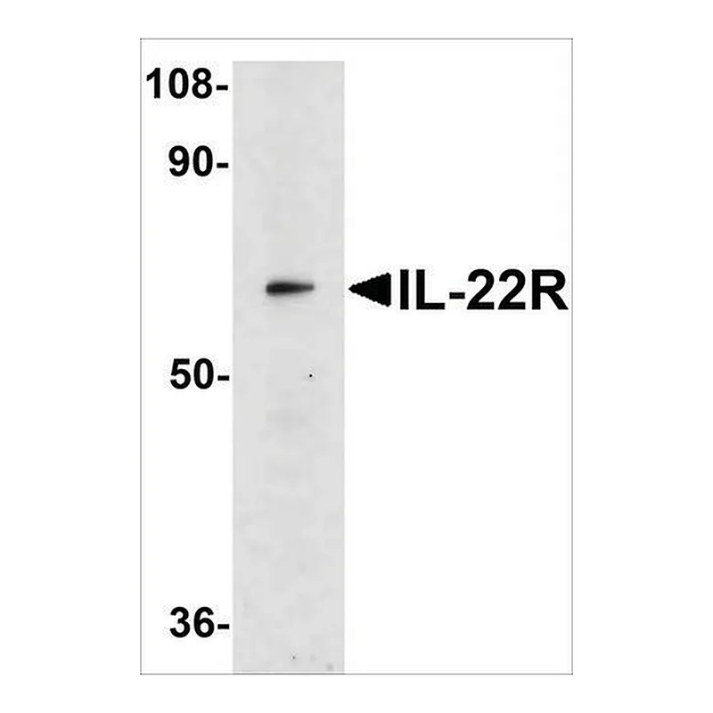 Merck Anti-IL-22 Receptor antibody produced in rabbit