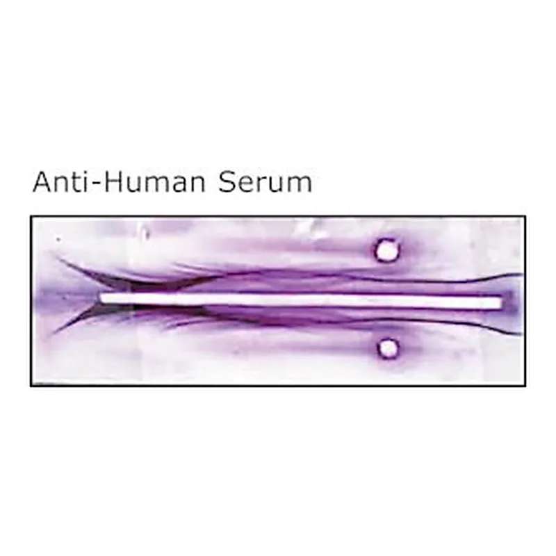 Merck ANTI-HUMAN WHOLE SERUM DEVELOPED IN GOA&