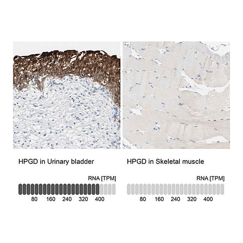 Merck Anti-HPGD antibody produced in rabbit