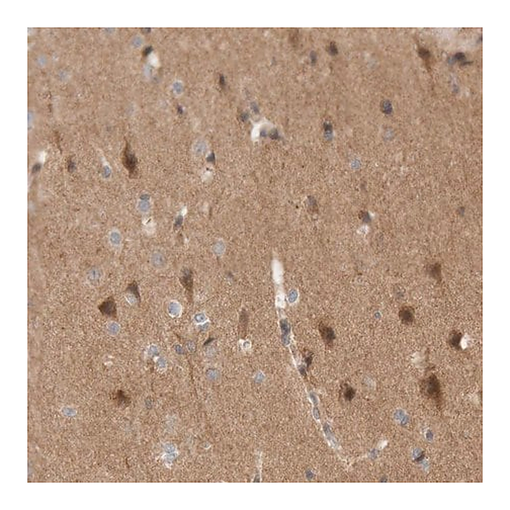 Merck Anti-KIF21B antibody produced in rabbit