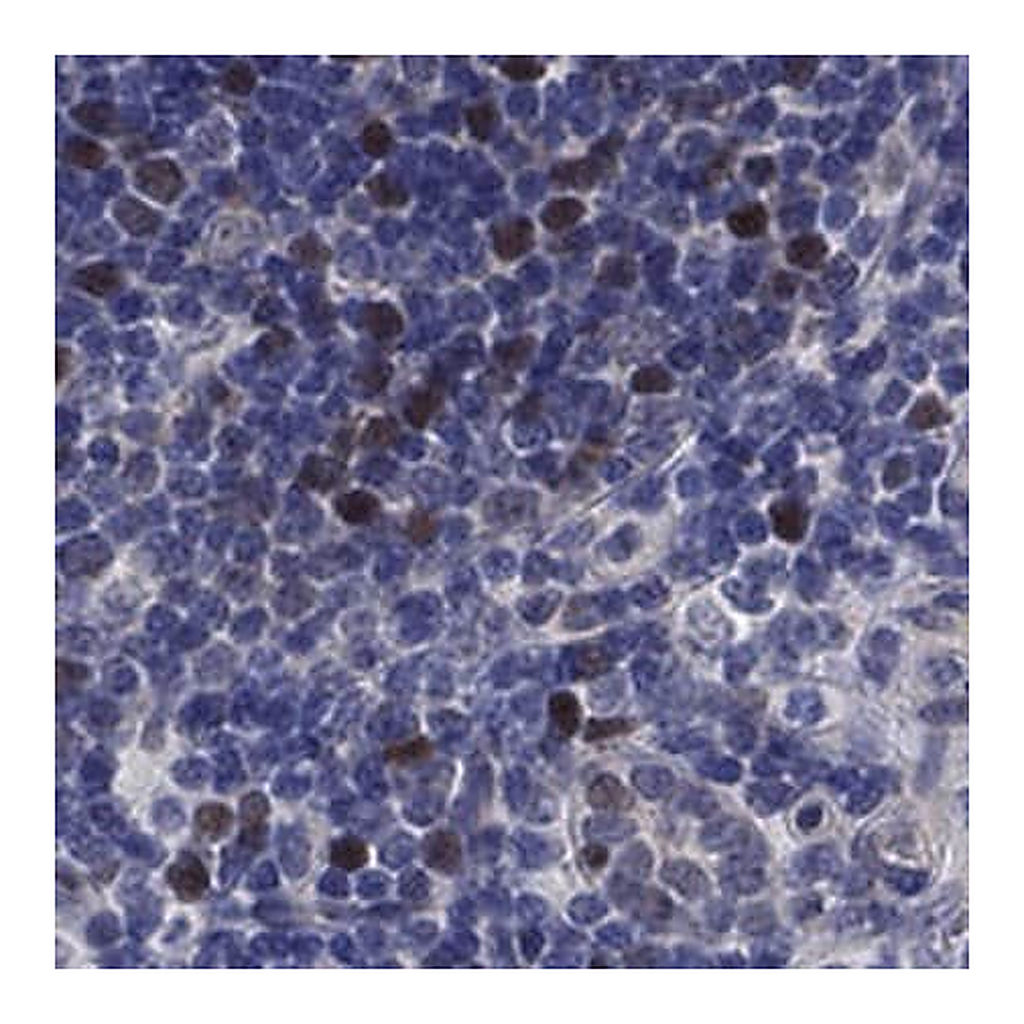 Merck Anti-E2F8 antibody produced in rabbit