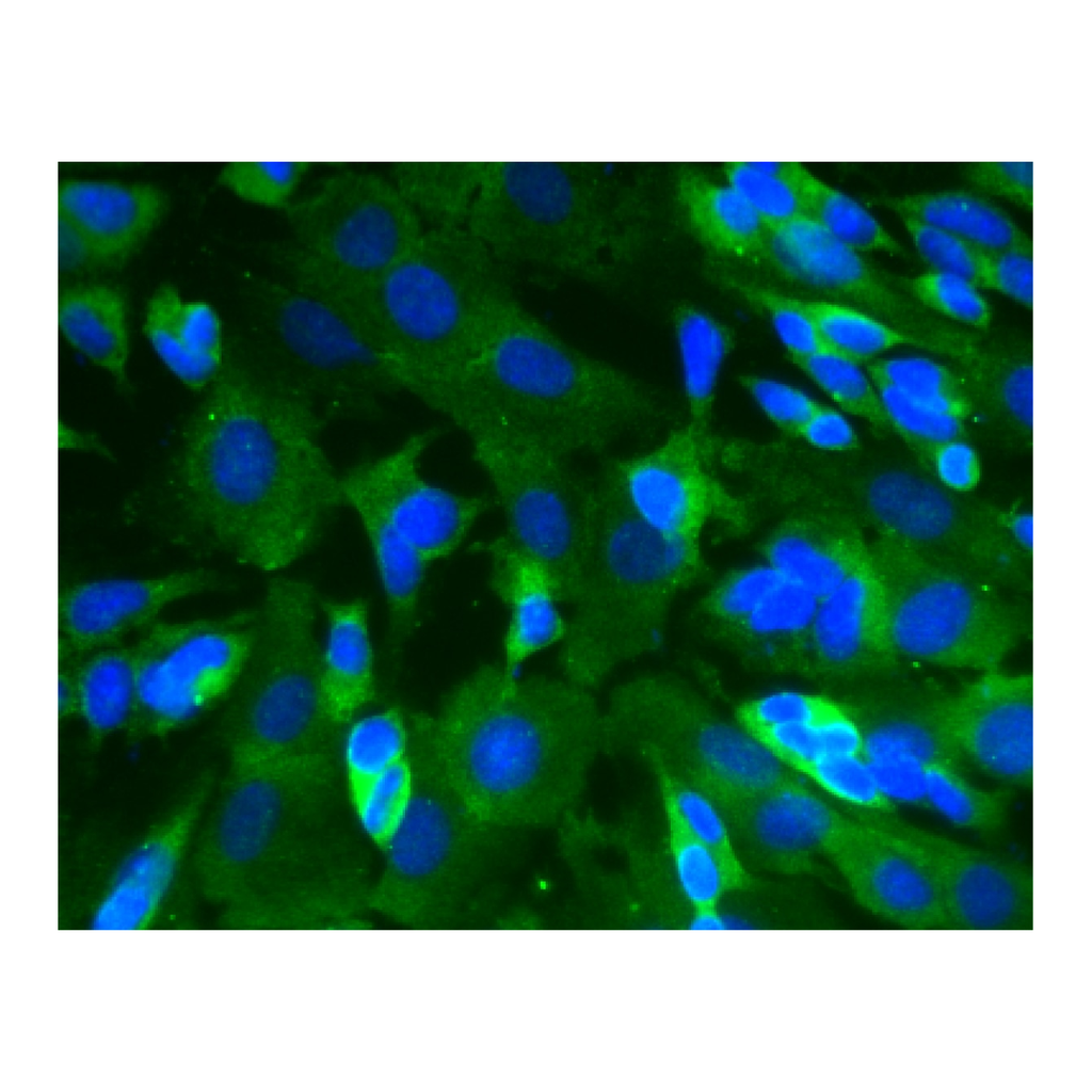 BD Purified Mouse Anti-CaM Kinase II
