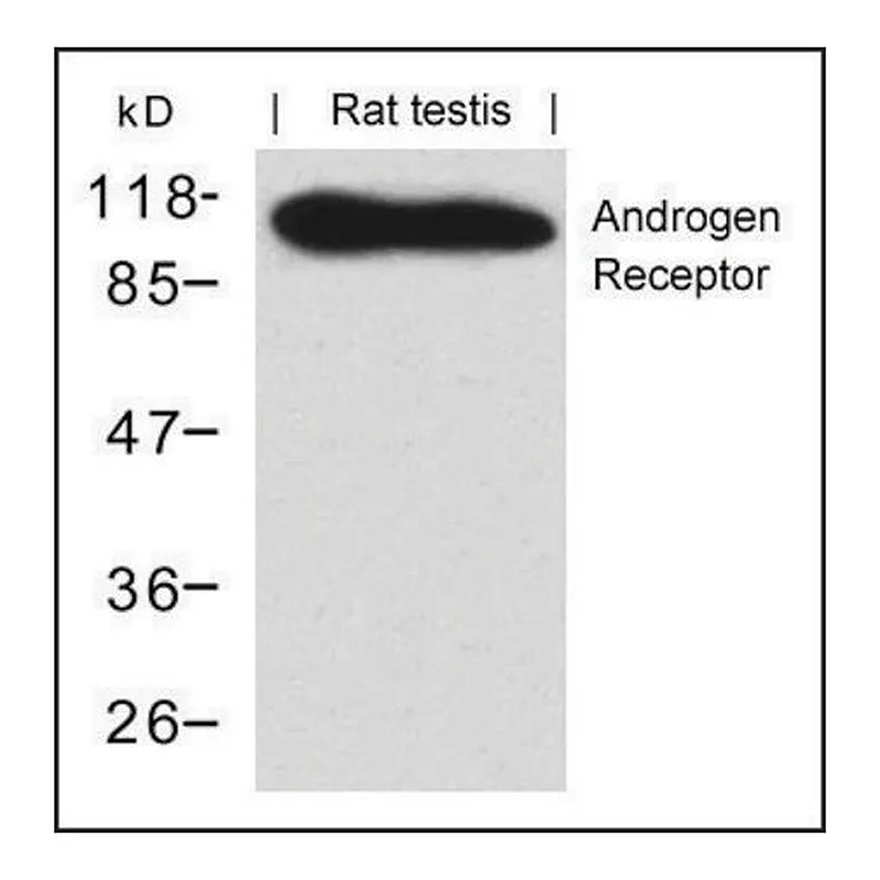 Merck Anti-AR (Ab-650) antibody produced in rabbit