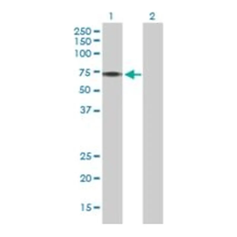 Merck ANTI-PINK1