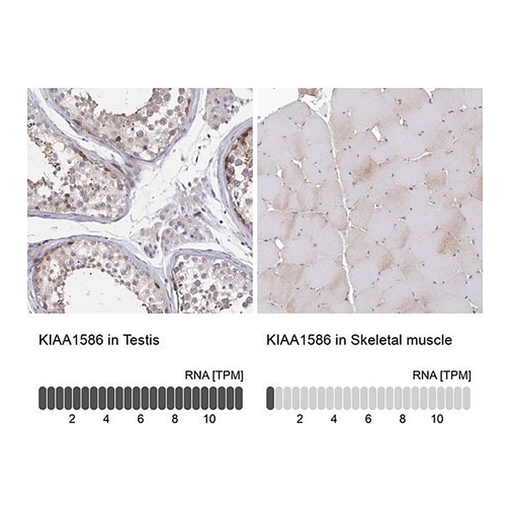 Merck Anti-KIAA1586 antibody produced in rabbit