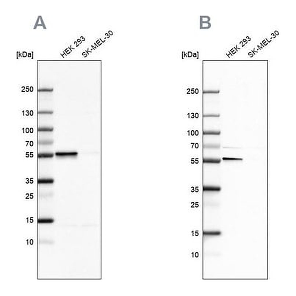 Merck Anti-FKBP5 antibody produced in rabbit