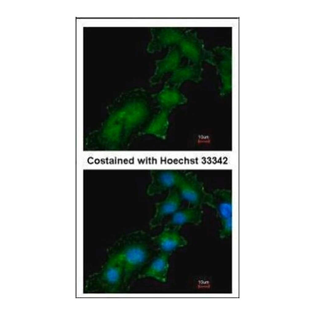 Merck Anti-ATP6AP2 antibody produced in rabbit