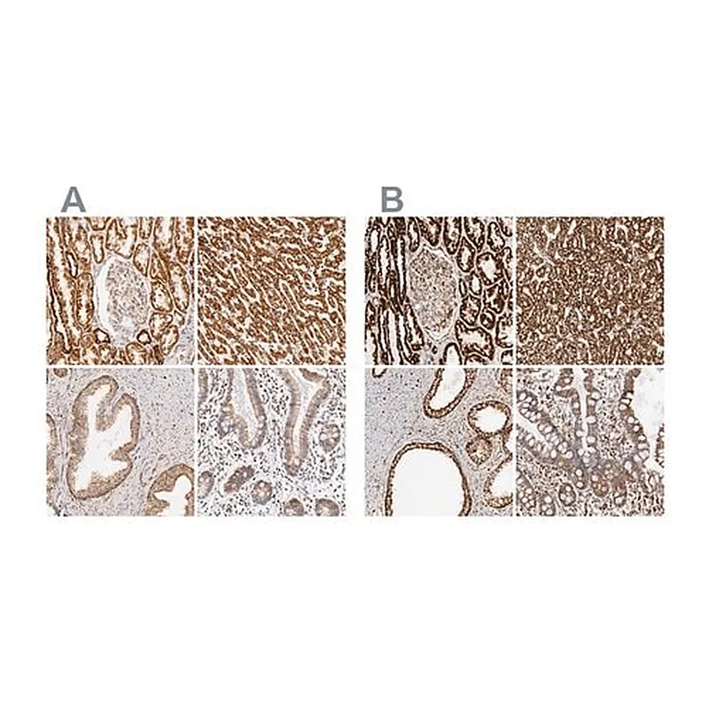 Merck Anti-ATP5B antibody produced in rabbit