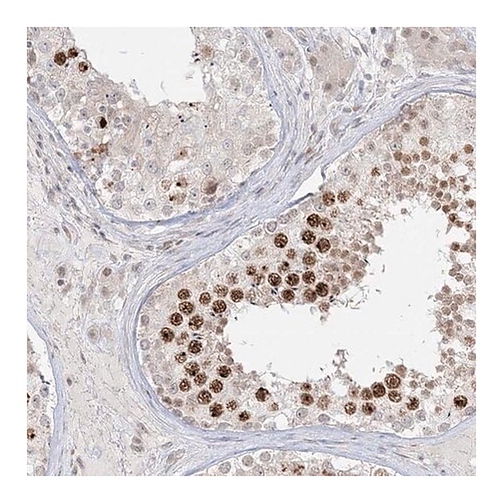 Merck Anti-PTK6 antibody produced in rabbit