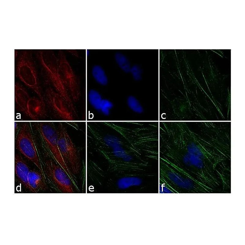 Thermo Fisher Scientific Donkey anti-Mouse IgG (H+L) Highly Cross-Adsorbed Secondary Antibody, TRITC