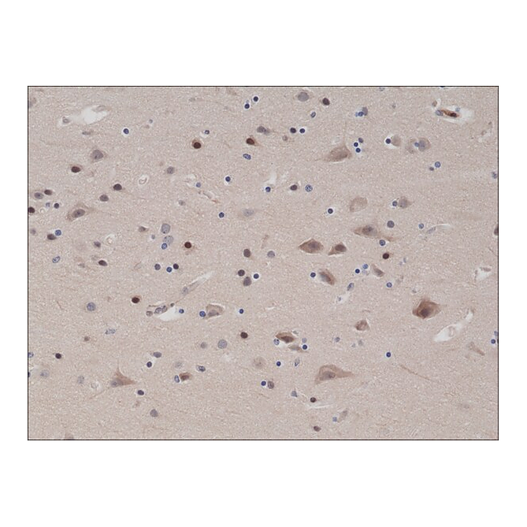 Merck Anti-PTEN antibody, Rabbit monoclonal