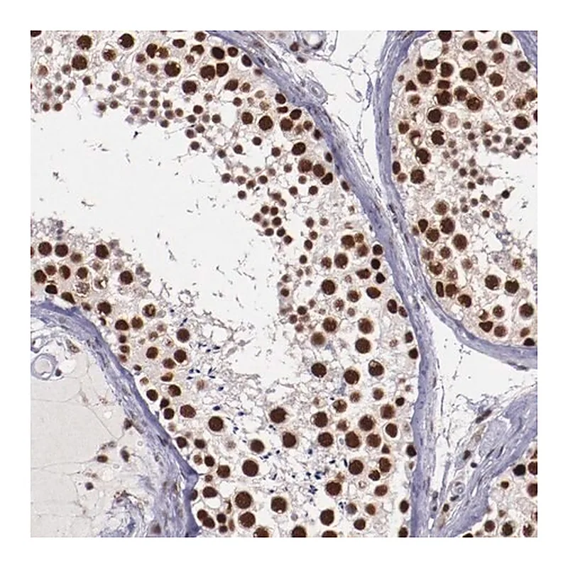 Merck Anti-PPP4R3A antibody produced in rabbit