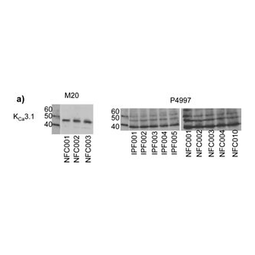 Merck ANTI-POTASSIUM CHANNEL KCA3.1
