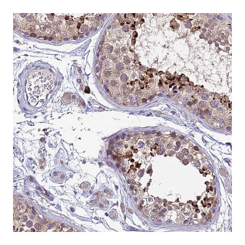 Atlas Antibodies Anti-THAP5 Antibody
