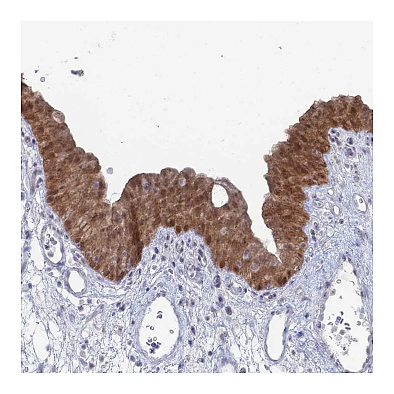 Atlas Antibodies Anti-THAP4 Antibody