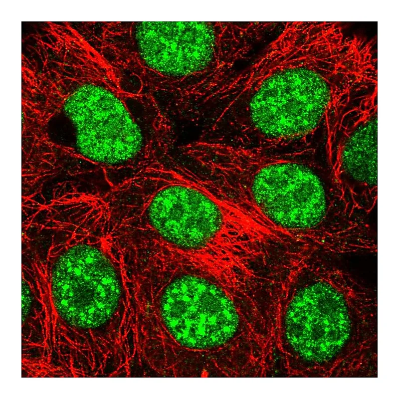 Atlas Antibodies Anti-THAP4 Antibody