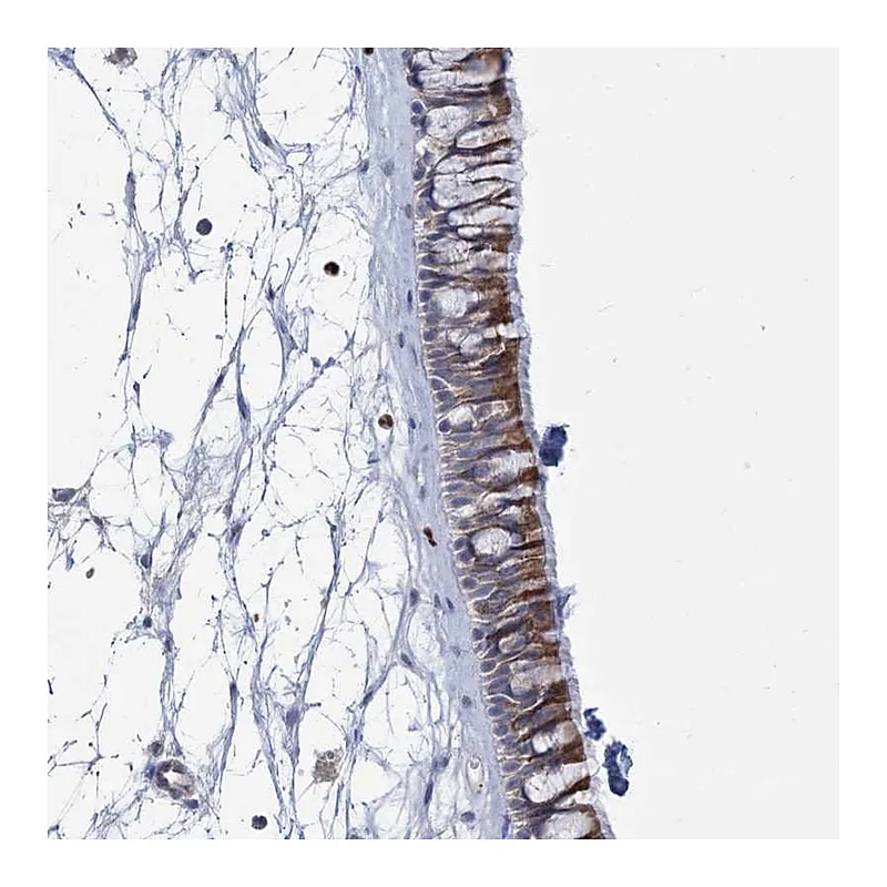 Atlas Antibodies Anti-THAP6 Antibody