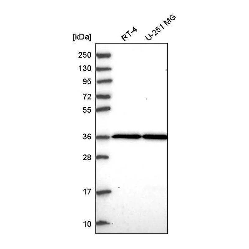 Atlas Antibodies Anti-THAP5 Antibody
