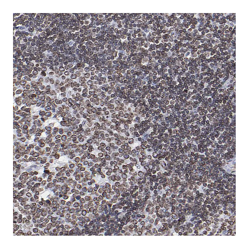 Atlas Antibodies Anti-THAP7 Antibody