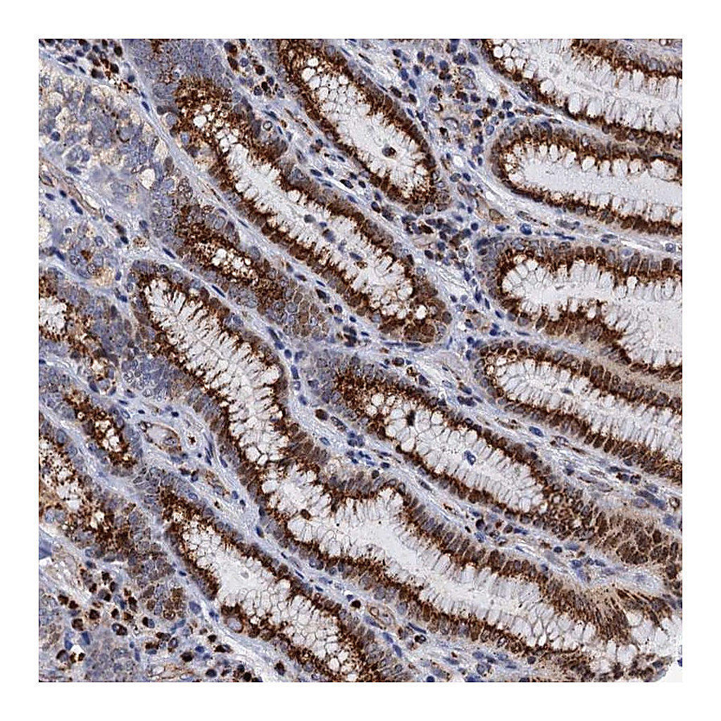 Atlas Antibodies Anti-THAP2 Antibody