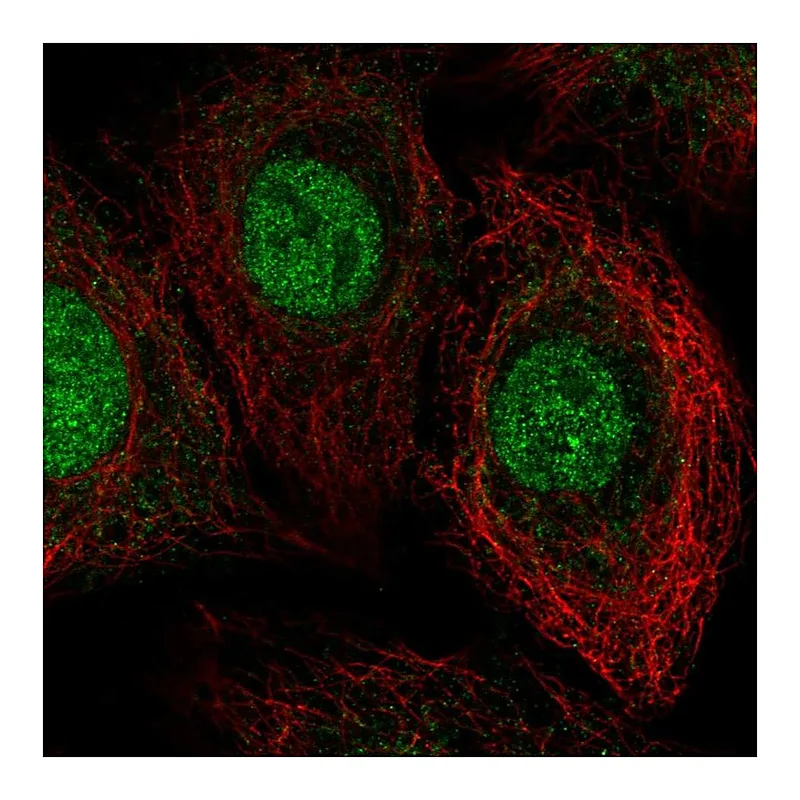 Atlas Antibodies Anti-THAP8 Antibody