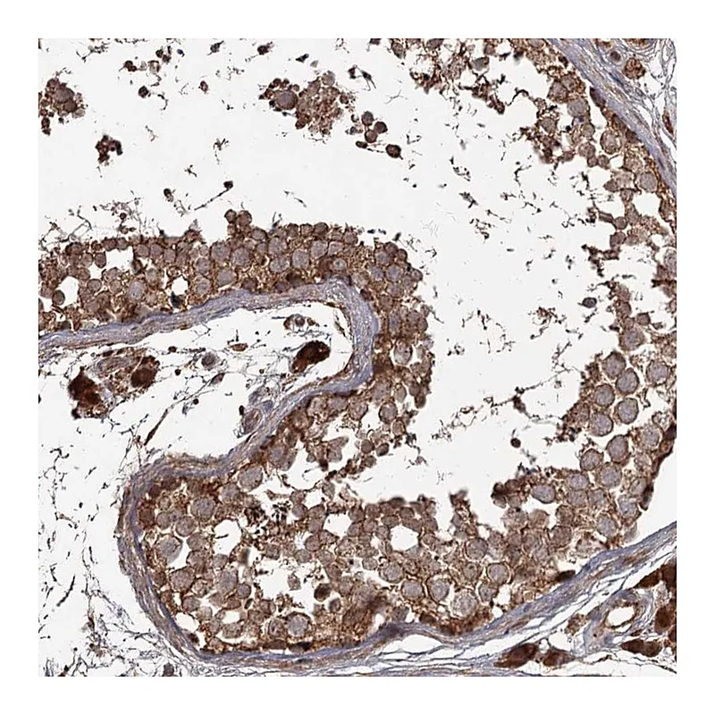 Atlas Antibodies Anti-THAP9 Antibody