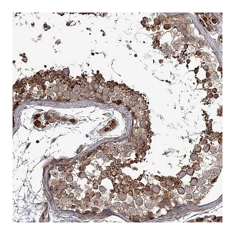 Atlas Antibodies Anti-THAP9 Antibody