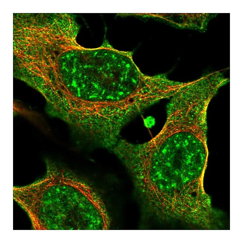 Atlas Antibodies Anti-THBS2 Antibody