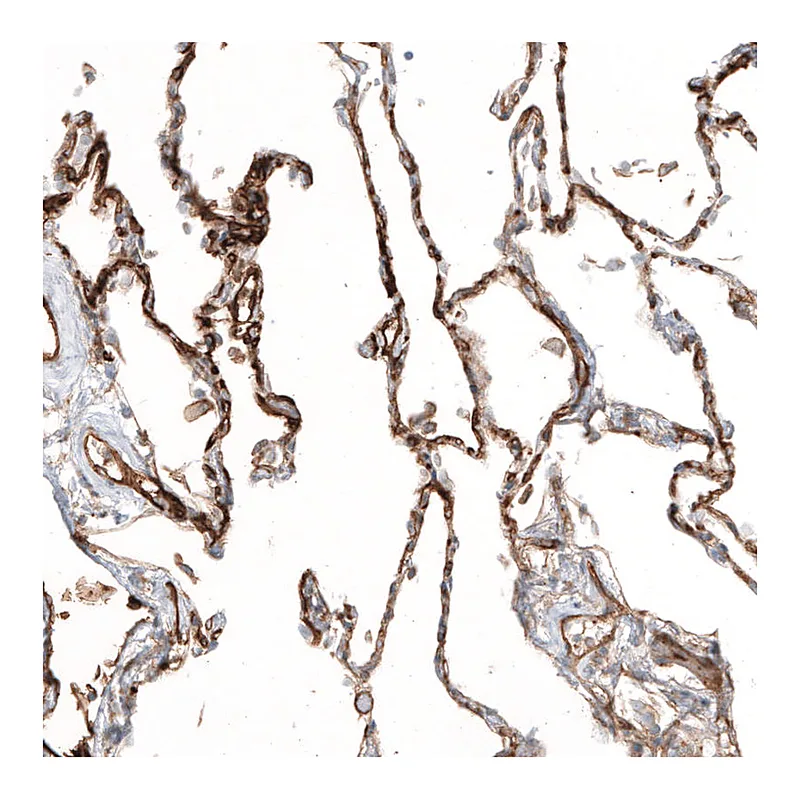 Atlas Antibodies Anti-THBD Antibody