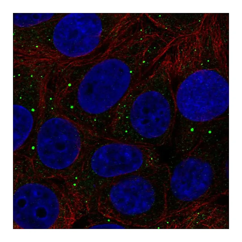 Atlas Antibodies Anti-THBS3 Antibody