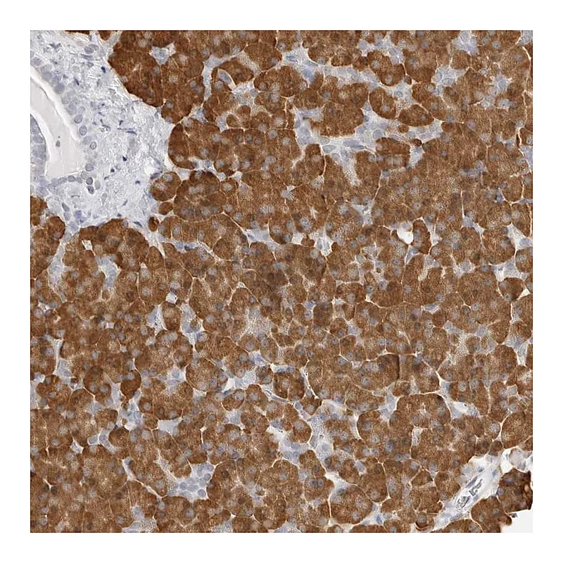Atlas Antibodies Anti-THEM4 Antibody