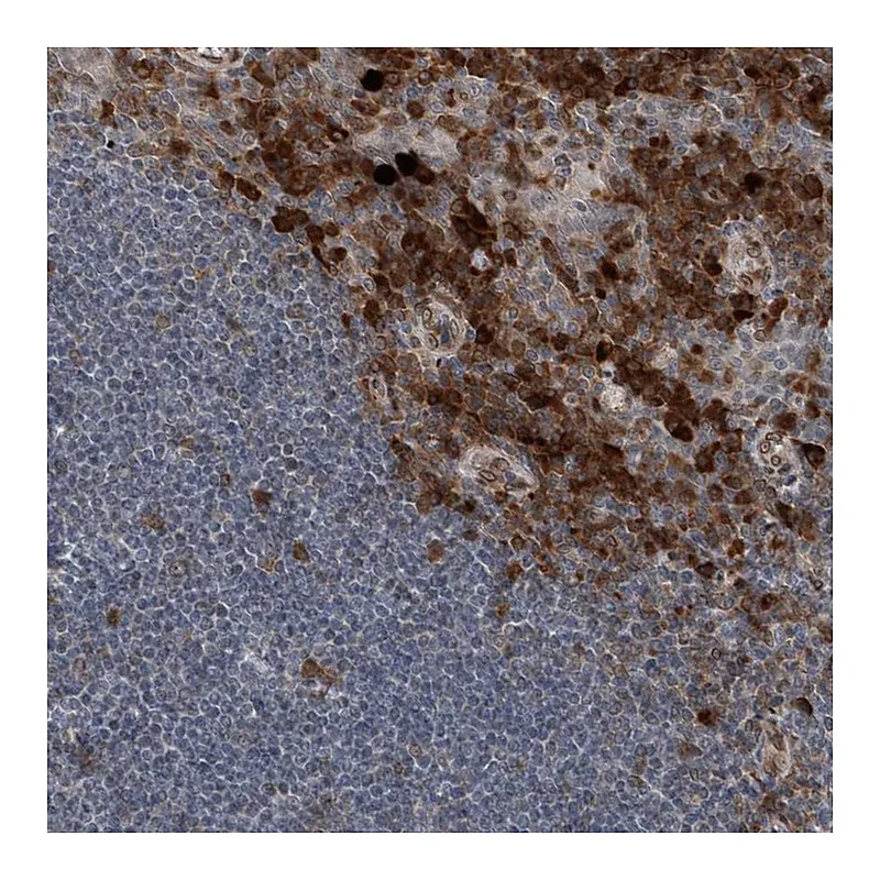 Atlas Antibodies Anti-THEMIS2 Antibody