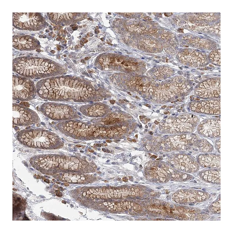 Atlas Antibodies Anti-THNSL1 Antibody