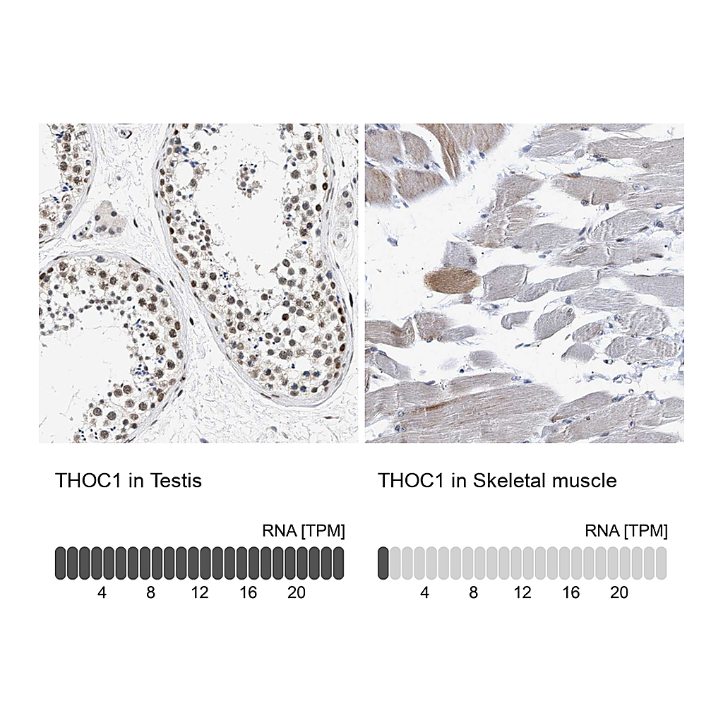 Atlas Antibodies Anti-THOC1 Antibody