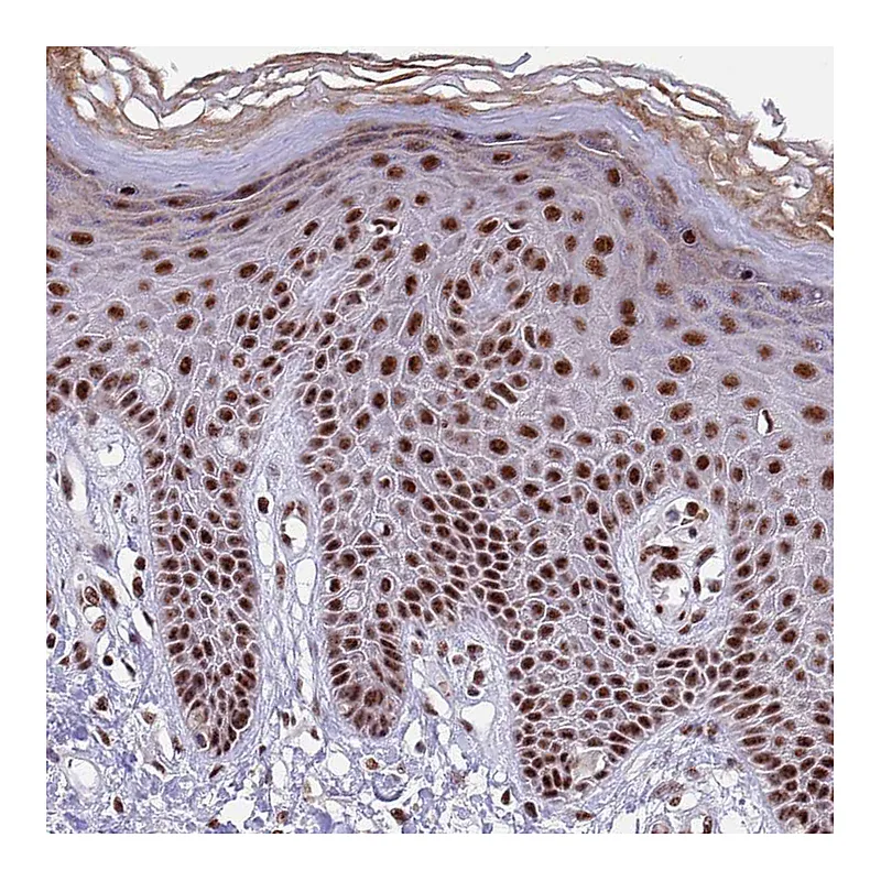 Atlas Antibodies Anti-THOC2 Antibody