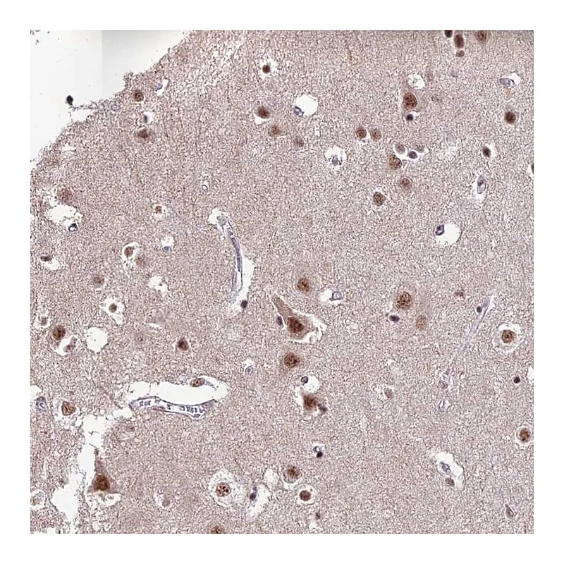 Atlas Antibodies Anti-THOC7 Antibody