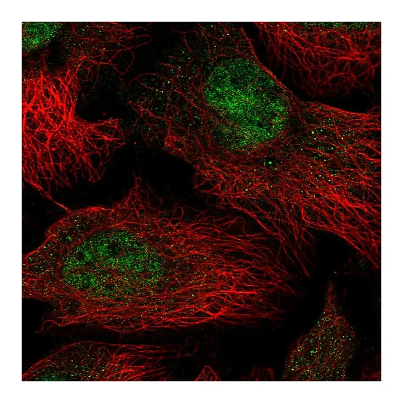 Atlas Antibodies Anti-THOC5 Antibody