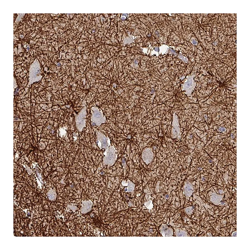 Atlas Antibodies Anti-THOP1 Antibody