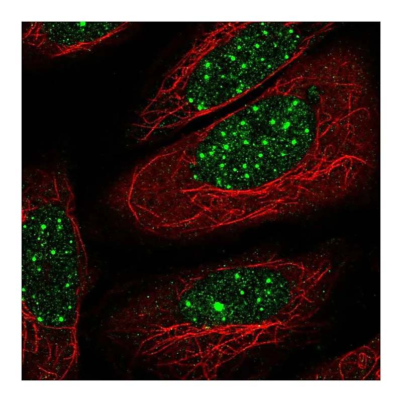 Atlas Antibodies Anti-THRB Antibody