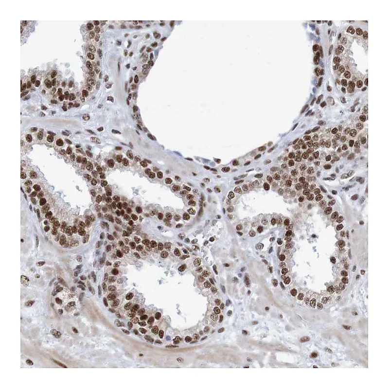 Atlas Antibodies Anti-THRAP3 Antibody