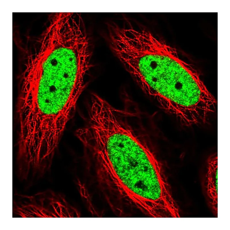 Atlas Antibodies Anti-THRAP3 Antibody