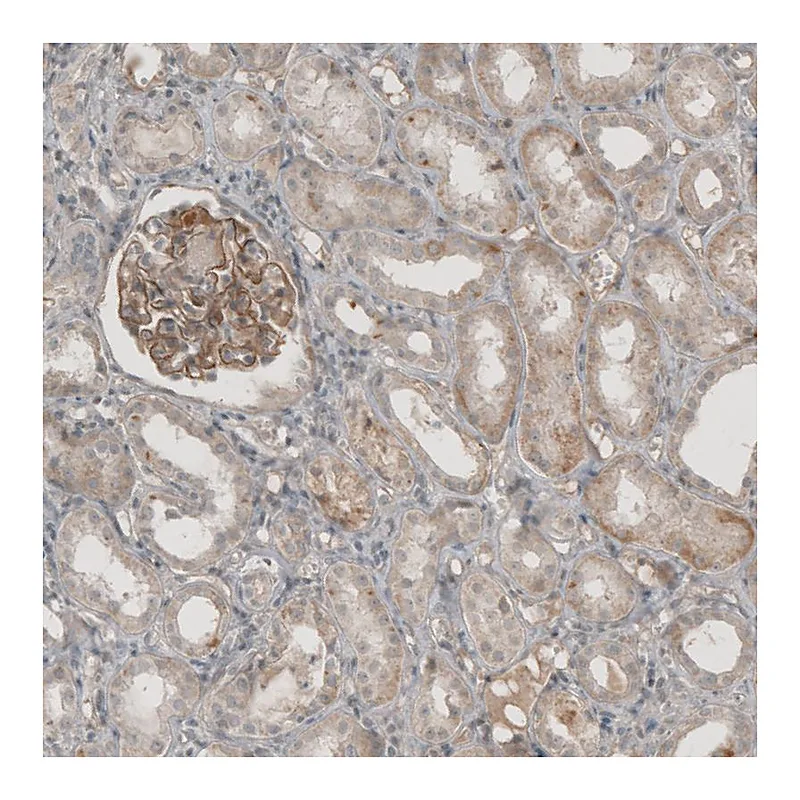 Atlas Antibodies Anti-THSD7A Antibody