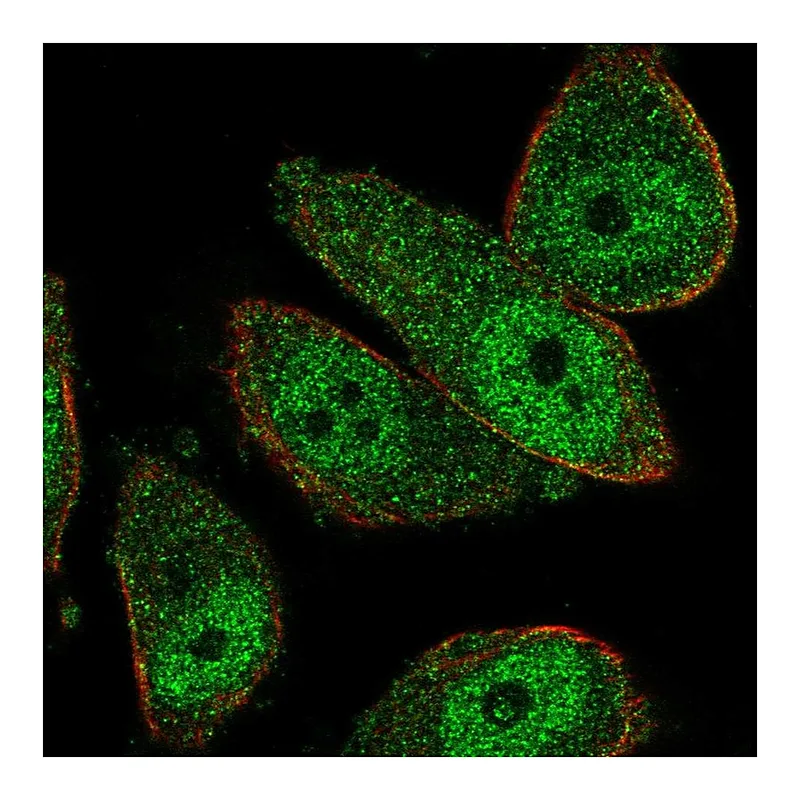 Atlas Antibodies Anti-THSD7B Antibody
