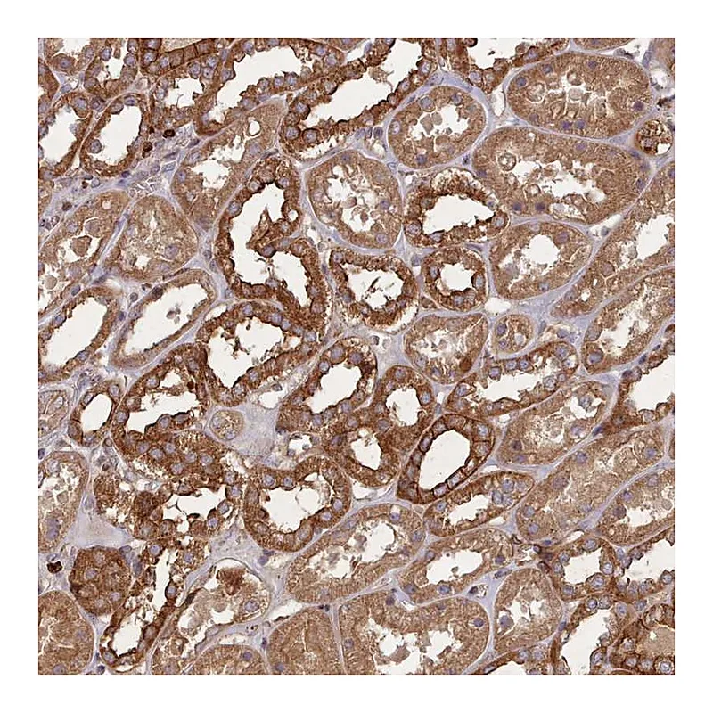 Atlas Antibodies Anti-THSD7B Antibody