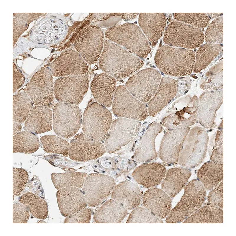 Atlas Antibodies Anti-THTPA Antibody