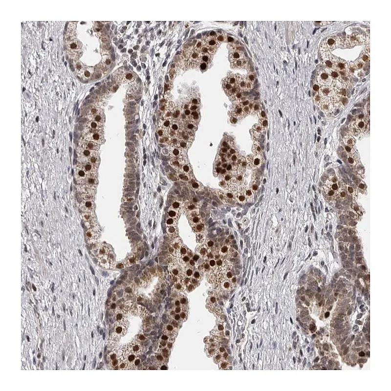 Atlas Antibodies Anti-THUMPD1 Antibody