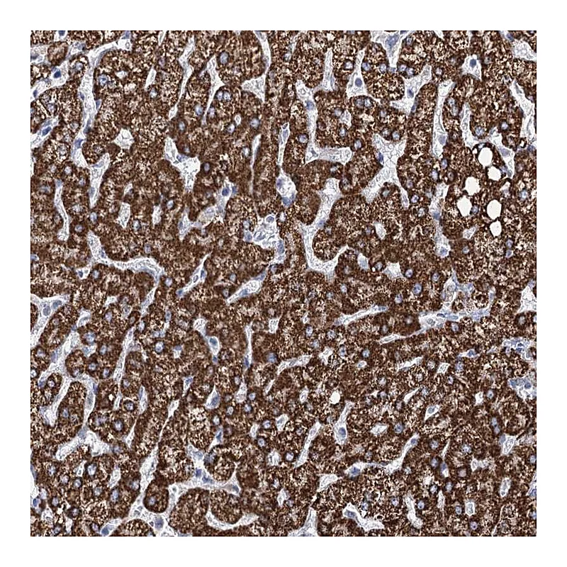 Atlas Antibodies Anti-THUMPD3 Antibody