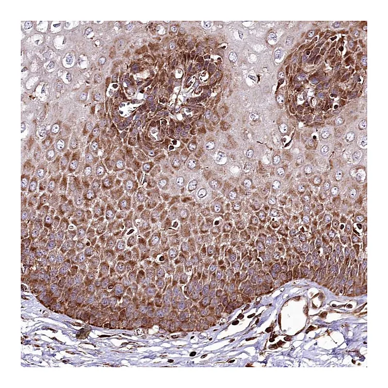 Atlas Antibodies Anti-THUMPD3 Antibody