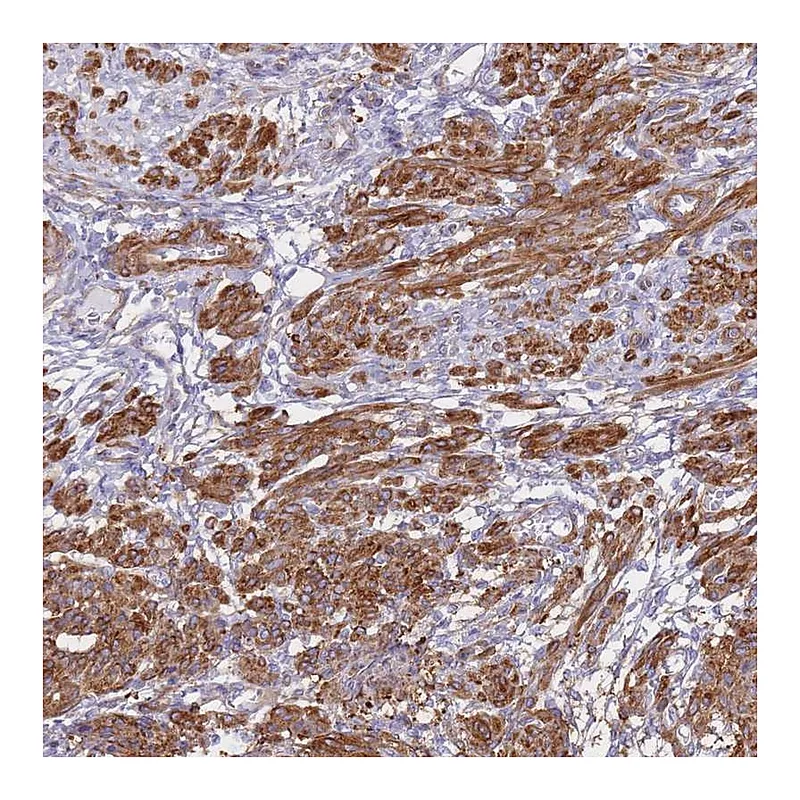 Atlas Antibodies Anti-TIAF1 Antibody